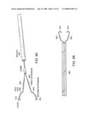 Gastrointestinal implant with drawstring diagram and image