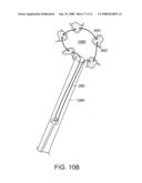 Gastrointestinal implant with drawstring diagram and image