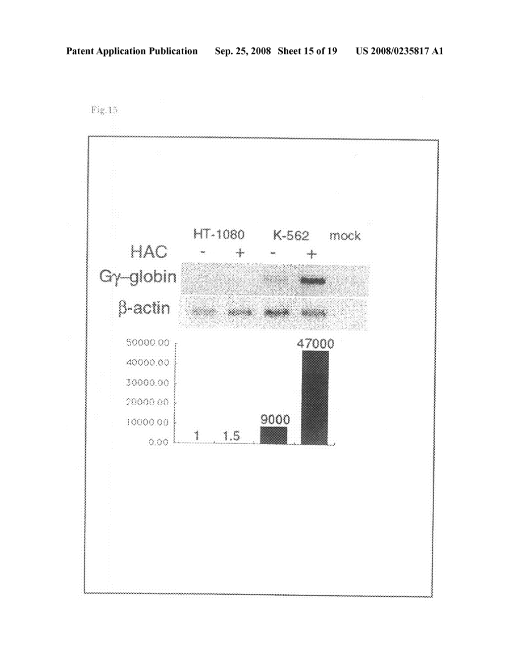 Artificial mammalian chromosome - diagram, schematic, and image 16