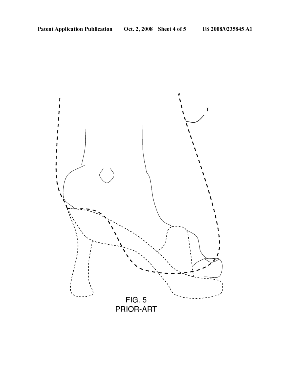 STIFFENING DEVICE FOR APPAREL - diagram, schematic, and image 05