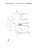 AXIAL FLOW SCAN TESTABLE FILTER SYSTEM diagram and image