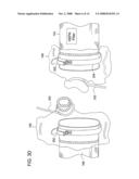 AXIAL FLOW SCAN TESTABLE FILTER SYSTEM diagram and image