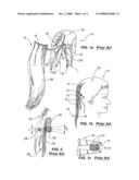 HAIR EXTENSION METHODS AND APPARATUS diagram and image