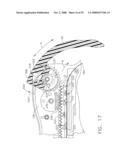 Surgical stapling and cutting instrument with side mounted retraction member diagram and image