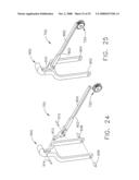 Surgical stapling and cutting instrument with side mounted retraction member diagram and image