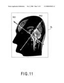 Magnetic resonance imaging apparatus and magnetic resonance imaging method diagram and image