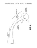 EYEWEAR WITH INTEGRATED BOTTLE CAP OPENER diagram and image