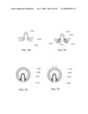 Pumping Cassette diagram and image