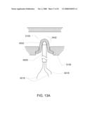 Pumping Cassette diagram and image