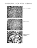 DEVICE WHICH ENHANCES THE BIOLOGICAL ACTIVITY OF LOCALLY APPLIED GROWTH FACTORS WITH PARTICULAR EMPHASIS ON THOSE USED FOR BONE REPAIR diagram and image