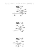 LOCAL VASCULAR DELIVERY OF PROBUCOL ALONE OR IN COMBINATION WITH SIROLIMUS TO TREAT RESTENOSIS, VULNERABLE PLAQUE, AAA AND STROKE diagram and image