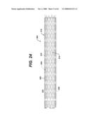 LOCAL VASCULAR DELIVERY OF PROBUCOL ALONE OR IN COMBINATION WITH SIROLIMUS TO TREAT RESTENOSIS, VULNERABLE PLAQUE, AAA AND STROKE diagram and image