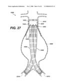 LOCAL VASCULAR DELIVERY OF PROBUCOL ALONE OR IN COMBINATION WITH SIROLIMUS TO TREAT RESTENOSIS, VULNERABLE PLAQUE, AAA AND STROKE diagram and image