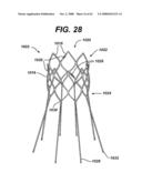 LOCAL VASCULAR DELIVERY OF PROBUCOL ALONE OR IN COMBINATION WITH SIROLIMUS TO TREAT RESTENOSIS, VULNERABLE PLAQUE, AAA AND STROKE diagram and image