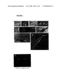 DIFFERENTIALLY EXPRESSED GENES INVOLVED IN ANGIOGENESIS, THE POLYPEPTIDES ENCODED THEREBY, AND METHODS OF USING THE SAME diagram and image