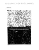 DIFFERENTIALLY EXPRESSED GENES INVOLVED IN ANGIOGENESIS, THE POLYPEPTIDES ENCODED THEREBY, AND METHODS OF USING THE SAME diagram and image