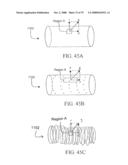 SYSTEMS AND METHODS OF PROMOTING ENGRAFTMENT OF A HYBRID HEMODIALYSIS ACCESS GRAFT OR A HYBRID FEMORAL ARTERY BYPASS GRAFT IN A MAMMAL diagram and image