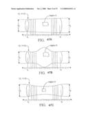 SYSTEMS AND METHODS OF PROMOTING ENGRAFTMENT OF A HYBRID HEMODIALYSIS ACCESS GRAFT OR A HYBRID FEMORAL ARTERY BYPASS GRAFT IN A MAMMAL diagram and image