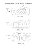 SYSTEMS AND METHODS OF PROMOTING ENGRAFTMENT OF A HYBRID HEMODIALYSIS ACCESS GRAFT OR A HYBRID FEMORAL ARTERY BYPASS GRAFT IN A MAMMAL diagram and image