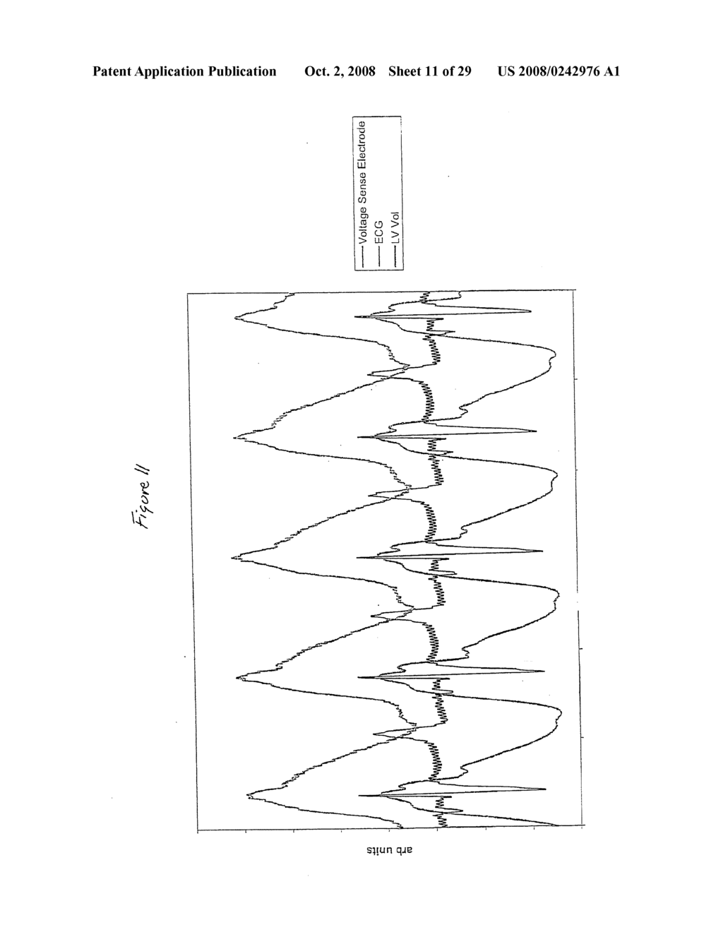 Electric field tomography - diagram, schematic, and image 12