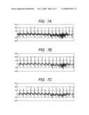 Method of compressing electrocardiogram data and electrocardiogram telemetry system using the same diagram and image