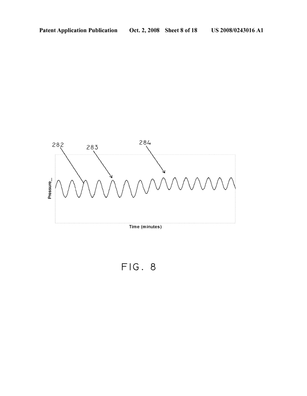 Pulmonary Artery Pressure Signals And Methods of Using - diagram, schematic, and image 09