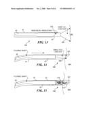 CATHETER WITH IMAGING CAPABILITY ACTS AS GUIDEWIRE FOR CANNULA TOOLS diagram and image