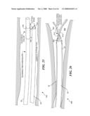 CATHETER WITH IMAGING CAPABILITY ACTS AS GUIDEWIRE FOR CANNULA TOOLS diagram and image