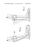 Ankle foot orthotic diagram and image