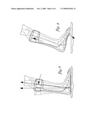 Ankle foot orthotic diagram and image