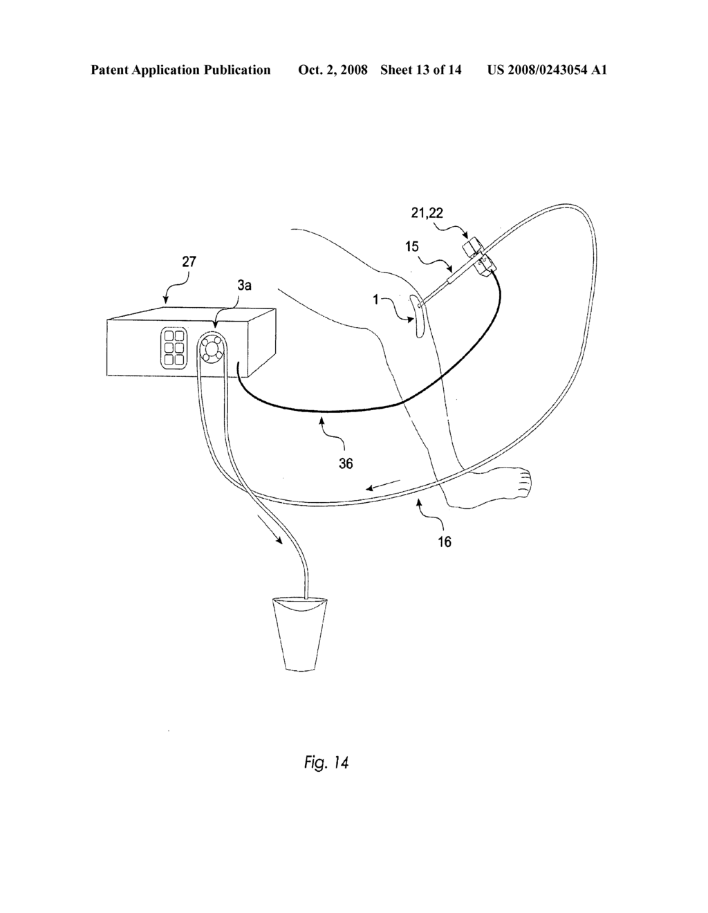 Method and device for irrigation of body cavities - diagram, schematic, and image 14