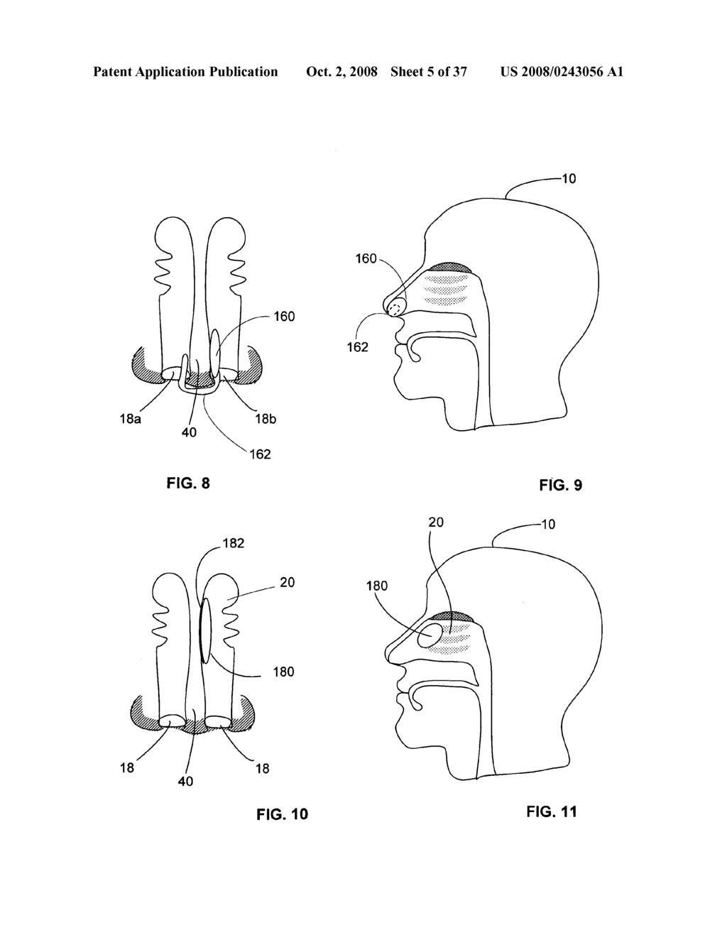 Controllable release nasal system - diagram, schematic, and image 06