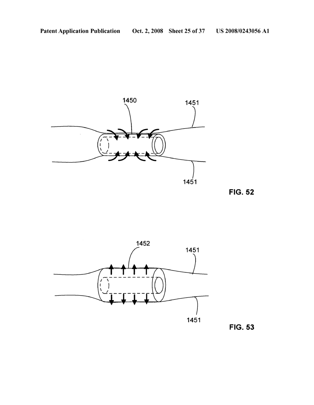 Controllable release nasal system - diagram, schematic, and image 26