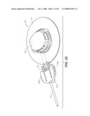 INFUSION SET KIT diagram and image