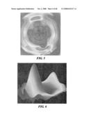 Surgical Tools for Arthroplasty diagram and image