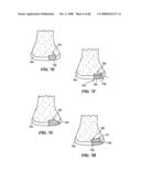 Surgical Tools for Arthroplasty diagram and image