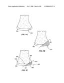 Surgical Tools for Arthroplasty diagram and image