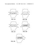 Surgical Tools for Arthroplasty diagram and image