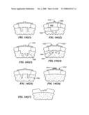 Surgical Tools for Arthroplasty diagram and image