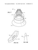 Surgical Tools for Arthroplasty diagram and image