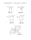 Surgical Tools for Arthroplasty diagram and image