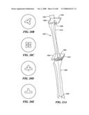 Surgical Tools for Arthroplasty diagram and image