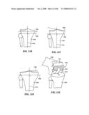 Surgical Tools for Arthroplasty diagram and image