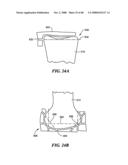 Surgical Tools for Arthroplasty diagram and image