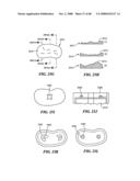 Surgical Tools for Arthroplasty diagram and image