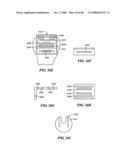 Surgical Tools for Arthroplasty diagram and image