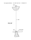 Surgical Tools for Arthroplasty diagram and image