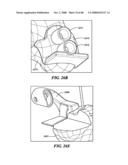 Surgical Tools for Arthroplasty diagram and image