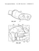 Surgical Tools for Arthroplasty diagram and image