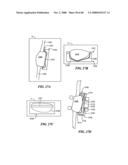 Surgical Tools for Arthroplasty diagram and image